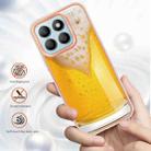 For Honor X8b Electroplating Marble Dual-side IMD Phone Case(Draft Beer) - 2