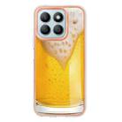 For Honor X8b Electroplating Marble Dual-side IMD Phone Case(Draft Beer) - 3