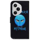 For Honor 400 Pro Global 160.8mm Coloured Drawing Flip Leather Phone Case(Anger) - 3