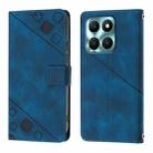 For Honor X6a Skin-feel Embossed Leather Phone Case(Blue) - 2