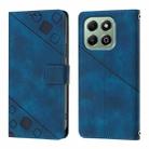 For Honor X6b Skin-feel Embossed Leather Phone Case(Blue) - 3