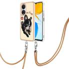 For Honor X7 Electroplating Dual-side IMD Phone Case with Lanyard(Lucky Dog) - 1