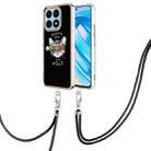 For Honor X8a Electroplating Dual-side IMD Phone Case with Lanyard(Natural Growth) - 1