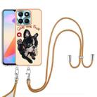 For Honor X6a Electroplating Dual-side IMD Phone Case with Lanyard(Lucky Dog) - 2