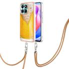 For Honor X6a Electroplating Dual-side IMD Phone Case with Lanyard(Draft Beer) - 1