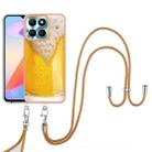 For Honor X6a Electroplating Dual-side IMD Phone Case with Lanyard(Draft Beer) - 2