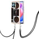 For Honor X6b Electroplating Dual-side IMD Phone Case with Lanyard(Retro Radio) - 1