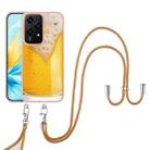 For Honor 200 Lite Global Electroplating Dual-side IMD Phone Case with Lanyard(Draft Beer) - 2