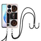 For Honor X7b 4G / 5G Electroplating Dual-side IMD Phone Case with Lanyard(Retro Radio) - 2