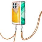 For Honor X8b Electroplating Dual-side IMD Phone Case with Lanyard(Draft Beer) - 1