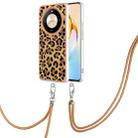 For Honor X9b Electroplating Dual-side IMD Phone Case with Lanyard(Leopard Print) - 1