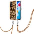 For Xiaomi Redmi Note 11s / Note 11 4G Electroplating Dual-side IMD Phone Case with Lanyard(Leopard Print) - 1