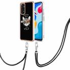 For Xiaomi Redmi Note 11s / Note 11 4G Electroplating Dual-side IMD Phone Case with Lanyard(Natural Growth) - 1