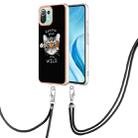 For Xiaomi Mi 11 Lite Electroplating Dual-side IMD Phone Case with Lanyard(Natural Growth) - 1