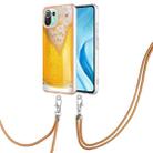 For Xiaomi Mi 11 Lite Electroplating Dual-side IMD Phone Case with Lanyard(Draft Beer) - 1