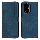 For Honor 400 Skin Feel Stripe Pattern Leather Phone Case with Lanyard(Blue) - 1