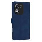 For Honor X70i AZNS Skin Feel Calf Texture Flip Leather Phone Case(Blue) - 3