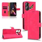 For ZTE nubia Neo 3 Skin Feel Magnetic Flip Leather Phone Case(Rose Red) - 1