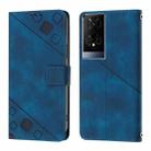 For TCL 50 XE Skin Feel Embossed Leather Phone Case(Blue) - 2