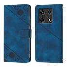 For Infinix Note 30 Pro / Note 30 5G Skin Feel Embossed Leather Phone Case(Blue) - 2