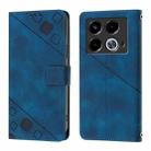 For Infinix Note 40 Skin Feel Embossed Leather Phone Case(Blue) - 2