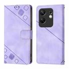 For Infinix Zero 30 4G Skin Feel Embossed Leather Phone Case(Light Purple) - 2