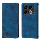 For Infinix Note 40 5G Skin Feel Embossed Leather Phone Case(Blue) - 2