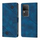 For vivo V30 5G / V30 Pro 5G Global Skin Feel Embossed Leather Phone Case(Blue) - 2