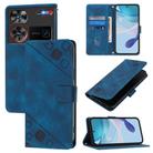 For ZTE nubia Z60 Ultra Skin Feel Embossed Leather Phone Case(Blue) - 1