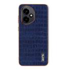 For Honor 400 Global 156.5mm AZNS Electroplated Frame Crocodile Texture Full Coverage Phone Case(Blue) - 2