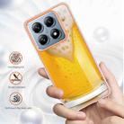 For Xiaomi 14T Electroplating Marble Dual-side IMD Phone Case(Draft Beer) - 2