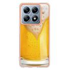 For Xiaomi 14T Electroplating Marble Dual-side IMD Phone Case(Draft Beer) - 3