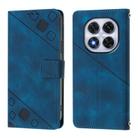 For Redmi Note 14 Pro 4G Skin-feel Embossed Leather Phone Case(Blue) - 2