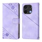 For UMIDIGI Note 100 Skin-feel Embossed Leather Phone Case(Light Purple) - 3