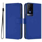 For TCL 50 XE Skin Feel Solid Color Leather Phone Case with Lanyard(Dark Blue) - 2