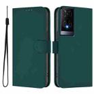 For TCL 50 XE Skin Feel Solid Color Leather Phone Case with Lanyard(Dark Green) - 2