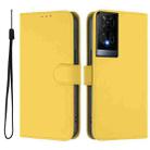 For TCL 50 XE Skin Feel Solid Color Leather Phone Case with Lanyard(Lemon Yellow) - 2