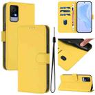 For TCL 405 / 406 / 408 Skin Feel Solid Color Leather Phone Case with Lanyard(Lemon Yellow) - 1