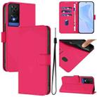 For TCL 505 Skin Feel Solid Color Leather Phone Case with Lanyard(Rose Red) - 1