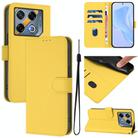 Infinix GT 20 Pro 5G Skin Feel Solid Color Leather Phone Case with Lanyard(Lemon Yellow) - 1
