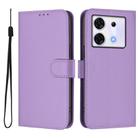 For Infinix Zero 30 5G Skin Feel Solid Color Leather Phone Case with Lanyard(Lavender Purple) - 2