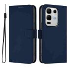For Infinix Note 50S Skin Feel Solid Color Leather Phone Case with Lanyard(Navy Blue) - 2