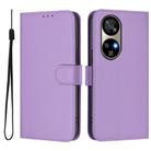 For Ulefone Note 17 Pro Skin Feel Solid Color Leather Phone Case with Lanyard(Lavender Purple) - 2