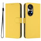 For Ulefone Note 17 Pro Skin Feel Solid Color Leather Phone Case with Lanyard(Lemon Yellow) - 2