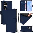 For Ulefone Note 17 Pro Skin Feel Solid Color Leather Phone Case with Lanyard(Navy Blue) - 1