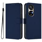 For Ulefone Note 17 Pro Skin Feel Solid Color Leather Phone Case with Lanyard(Navy Blue) - 2