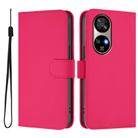 For Ulefone Note 17 Pro Skin Feel Solid Color Leather Phone Case with Lanyard(Rose Red) - 2
