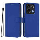 For Umidigi G9 5G Skin Feel Solid Color Leather Phone Case with Lanyard(Dark Blue) - 2