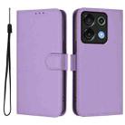 For Umidigi G9 5G Skin Feel Solid Color Leather Phone Case with Lanyard(Lavender Purple) - 2