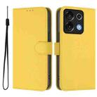 For Umidigi G9 5G Skin Feel Solid Color Leather Phone Case with Lanyard(Lemon Yellow) - 2